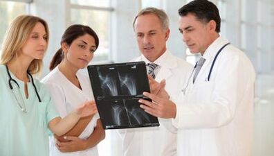 Arthritis -Optionen und Osteoarthis -Therapie