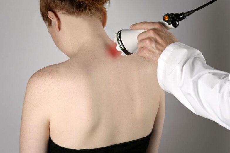 Laserbehandlung der zervikalen Osteochondrose bei Frauen.